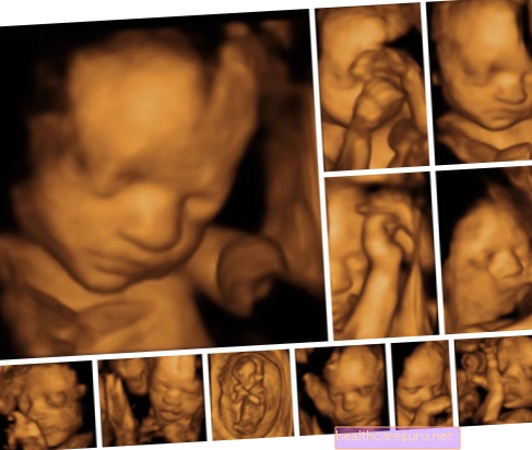 Morfologisk ultralyd: hvad det er, hvad det er til, og hvornår man skal gøre det
