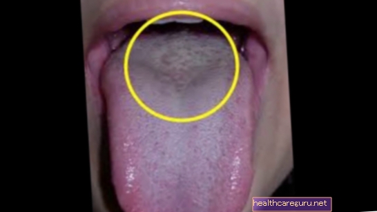 Sådan rengøres babyens tunge og mund