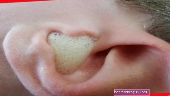 Sådan rengøres babyens øre