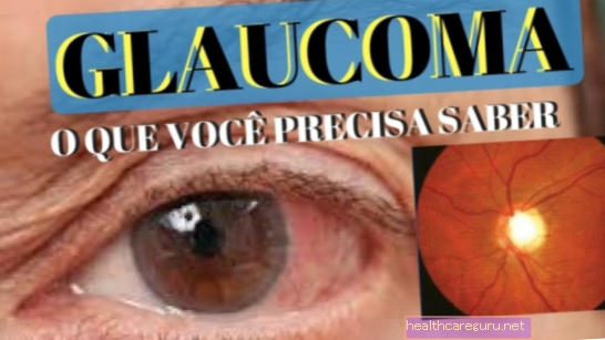 Glaukooma: mikä se on ja 9 pääoireita