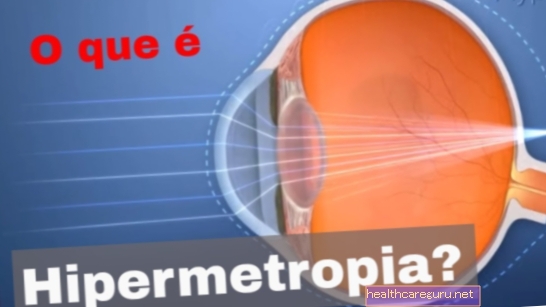 Hyperopi: hva det er og viktigste symptomer