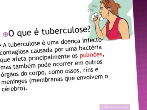 Čo je očná tuberkulóza, príznaky a ako liečiť