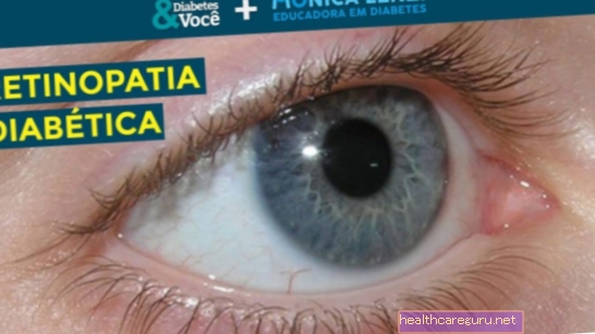 Kaj je diabetična retinopatija, simptomi in kako naj bo zdravljenje