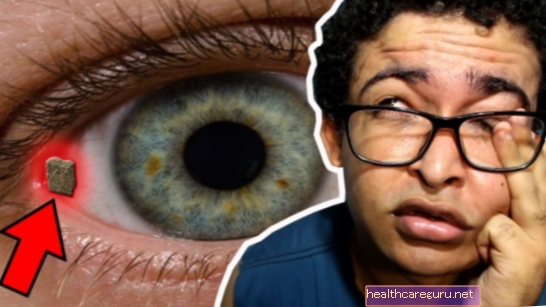 Как да премахнете петънцето от окото