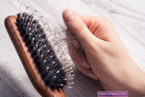 3 علاجات منزلية لتساقط الشعر