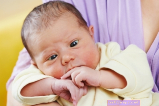 טיפול בפזילה לתינוקות