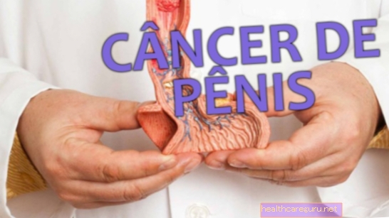 Cancerul penisului: ce este, simptome, cauze și tratament