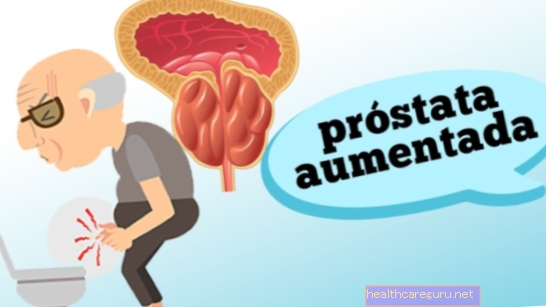 Prostate: τι είναι, πού είναι, τι είναι (και άλλες αμφιβολίες)