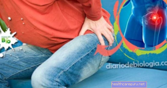 11 узрока болова у колену и шта треба радити
