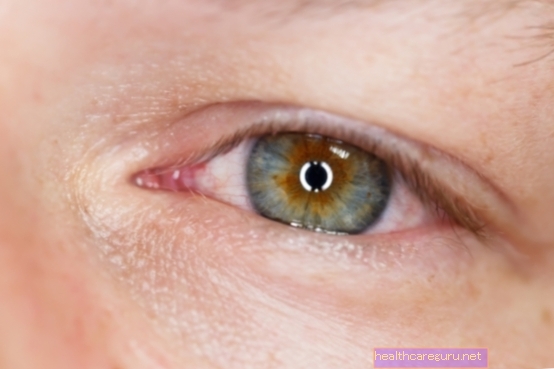 6 penyebab utama mata gatal dan apa yang perlu dilakukan