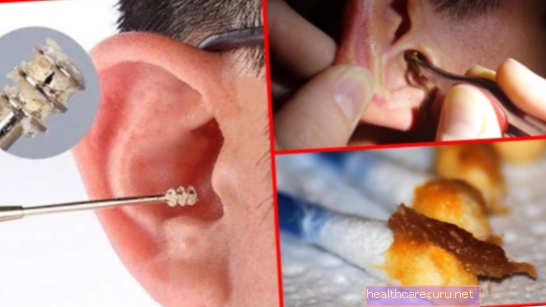 Kako dobiti vosak za uši kod kuće