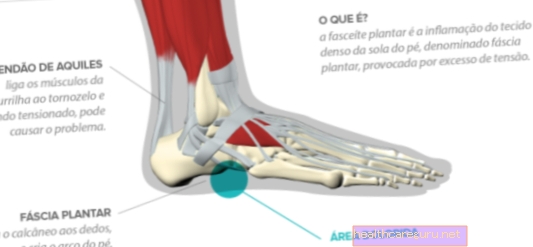 Ból w boku stopy: 5 przyczyn i kiedy iść do lekarza