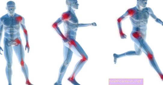 Bolovi u zglobovima: 8 glavnih uzroka i što učiniti