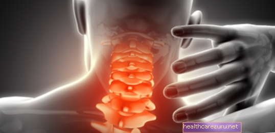 Cervikal spondylose: hvad det er, symptomer og behandling