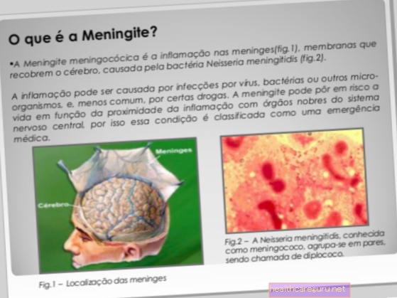 C meningīts: kas tas ir, galvenie simptomi un ārstēšana