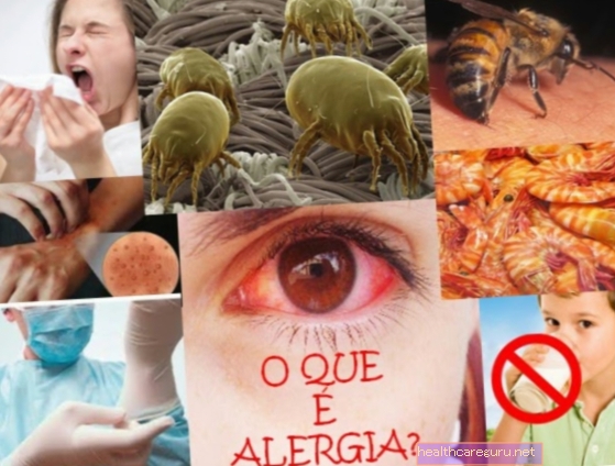 Qu'est-ce que l'allergie alimentaire, les symptômes, les principales causes et le traitement