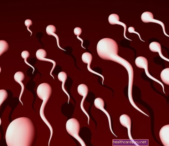 Kas sukelia gelsvą spermatozoidą ir ką daryti