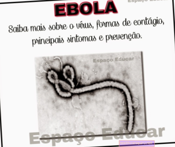 Hlavné príznaky eboly