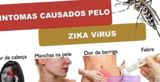 Symptomer forårsaket av Zika-viruset