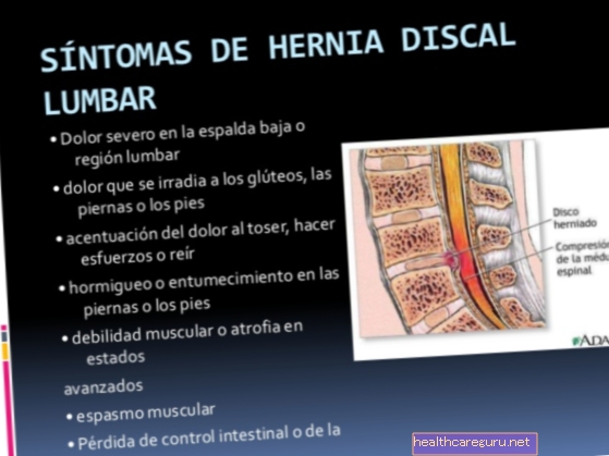 Symptomer på lumbal, cervical og thorax Disc herniation og hvordan du kan forebygge