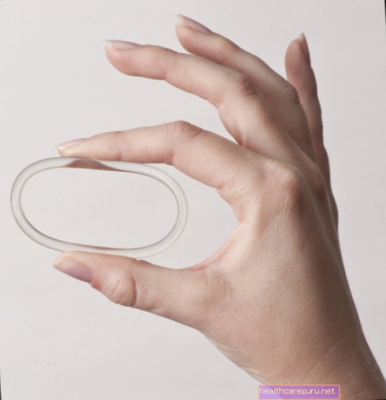 Vaginale ring (Nuvaring): wat het is, hoe het te gebruiken en voordelen