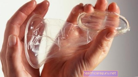 Kvinnlig kondom: vad det är och hur man uttrycker det korrekt