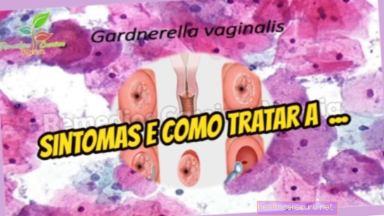 Gardnerella vaginalis: תסמינים, איך להשיג את זה וטיפול