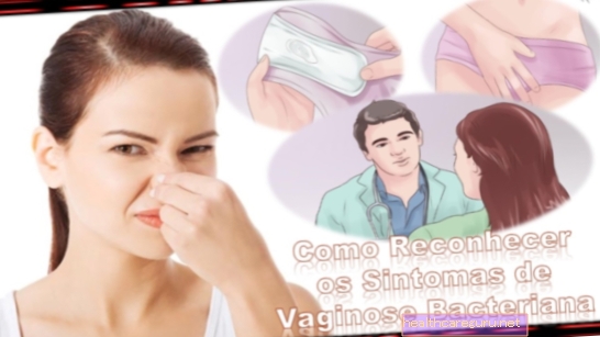 Бактериална вагиноза: какво представлява, симптоми и лечение
